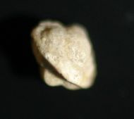 Bynumina lirae Kurtz 1975