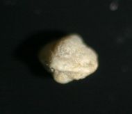 Bynumina lirae Kurtz 1975